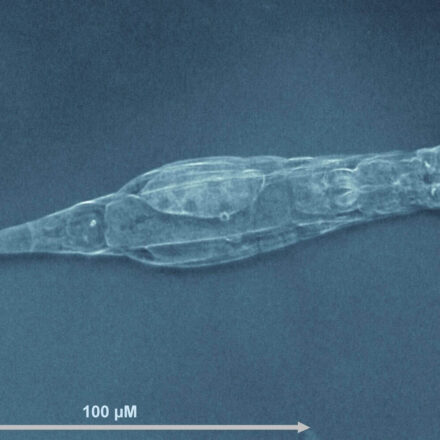 Imagem de microscopia de um rotífero Adineta vaga visto de perfil, com escala de 100 micrômetros